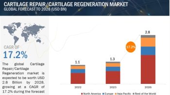 Regenerating Growth: Europe’s $2.8B Cartilage Repair / Cartilage Regeneration Market Forecast